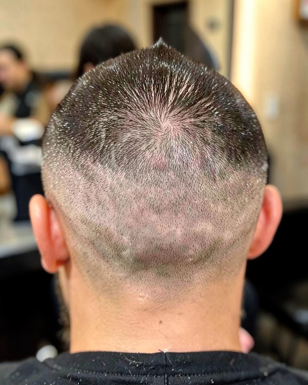 Degradê na pele com acabamento detalhado na nuca